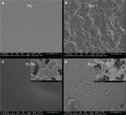 Figure 3 Scanning electron microscopic images of (A) PU control, (B) nanomodified PU, (C) PLGA control, and (D) nanomodified PLGA. Scale bars = 10 μm. Insets in (C) and (D) are unmodified and nanomodified porous PLGA layers under low magnification, respectively.Abbreviations: PU, polyurethane; PLGA, poly-lactic-co-glycolic acid.