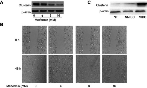 Figure 4 (A) Metformin significantly decreases Clusterin expression. Murine bladder cancer cells (MB49) were treated with metformin for 48 hrs and Clusterin expression was detected using Western blot, ß-actin as a loading control. (B) metformin inhibited cells migration in wound healing assays. (C) Clusterin expression in tissues was evaluated using immunohistochemistry. Three groups of specimens (N=3 for adjacent normal tissues (NT), non-muscle invasive bladder cancer (NMIBC) and muscle-invasive bladder cancer (MIBC) tissues, respectively) were paraffin-embedded, sectioned and immunohistochemically stained with anti-Clusterin.