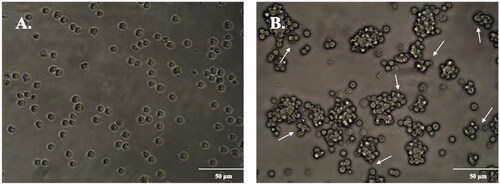 Figure 1. PMA induces the transition from THP-1 cells to MDMs. (A) Control cells treated with culture medium alone demonstrated a globular appearance with no cell-cell interactions. (B) Cells treated with 100 ng/mL of PMA assumed adherent morphology with apparent cell aggregation and pseudopodia (marked by arrows), representing MDMs.
