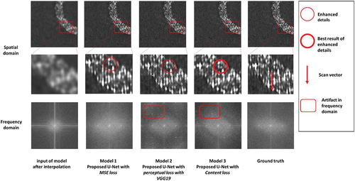 Figure 10. Enhanced image with proposed U-Net with different loss function and their frequency transformation.