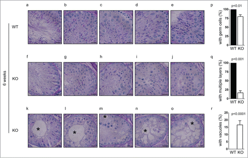 Figure 3. Germ cells are decreased in small testes from Chfr knockout male mice at 6 weeks. Testis sections of 12-week-old male mice were stained with periodic acid schiff (PAS)-hematoxylin. Typical pictures of normal testes from WT male mice (a-e) and small testes from Chfr knockout male mice (f-o) are shown. Scale bar, 50 µM. Asterisk: large vacuoles. (p-r) Seminiferous tubules with germ cells (p), with multiple layers of germs cells (q), and with large vacuoles (r) are summarized. Mean and standard deviation are shown.