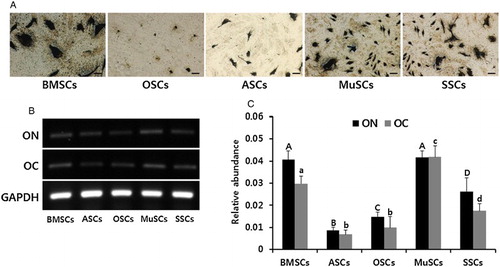 Figure 5. In vitro differentiation ability into osteocytes and the expression of lineage-specific genes in mini-pig BMSCs, ASCs, OSCs, MuSCs and SSCs, respectively. (A) Each cell line was induced into adipogenic lineages for four weeks and intracellular accumulation of mineralization was stained by silver nitrate solution. Scale bars, 50 µm. (B) Adipogenic differentiation was evidenced by the expression of ON and OC by RT-PCR. (C) Values indicated the mean transcript levels (mean ± SEM) of three replicates and calculated to ratio based on the level of GAPDH, an internal control gene. A, B, C and D indicate significant (P < .05) difference on ON transcript among MSCs, respectively. a, b, c and d indicate significant (P < .05) difference on OC transcript among MSCs, respectively.