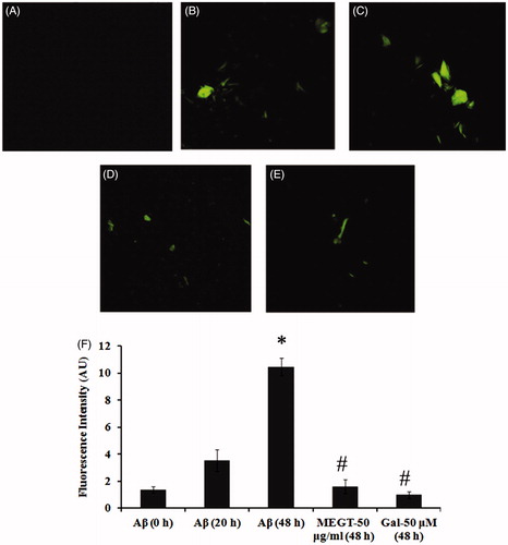 Figure 4. Confocal microscopic images indicating the anti-aggregation effect of MEGT (A) Aβ25–35 (0 h), (B) Aβ25–35 (20 h), (C) Aβ25–35 (48 h), (D) MEGT-50 μg/mL (48 h) and (E) galanamine-50 μM (48 h). (F) Quantification of anti-aggregation of Aβ25–35 by MEGT by Th-T fluorimetric assay. Significant level at p < 0.05 (*Aβ25–35 (0 h) versus Aβ25–35 (48 h); #Aβ25–35 (48 h) versus GT-50 μg/mL (48 h)/Gal-50 μM (48 h)).