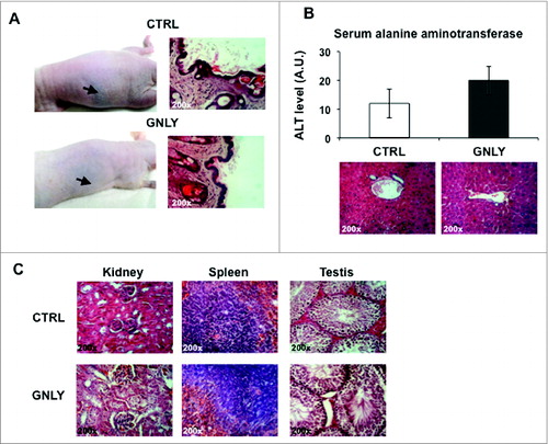 Figure 7. Study of the possible adverse effects of granulysin alone. (A, left panels) Representative images of nude mice that received five s.c. PBS injections (CTRL) or five s.c. granulysin injections (GNLY) in the absence of tumor development. Arrows indicate the place were injections were performed. Right panels, representative histological images of skin sections of both groups of mice stained with H&E. n = 5 in each experimental group. (B) Nude mice were injected intraperitoneally (i.p.) with PBS (CTRL) or with granulysin (GNLY) for five times with a 3-d interval. Upper panel, determination of hepatic serum alanine aminotransferase (ALT) in sera of mice from both groups. Data are the mean ± SD of ALT levels in both groups of mice, n = 5 in each experimental group. Lower panel, representative histological section of liver tissue sections from both groups of mice stained with H&E. (C) Representative photomicrographs of several tissues (kidney, spleen, and testis) in granulysin or PBS-treated mice from the same experiment shown in B after H&E staining, as indicated.