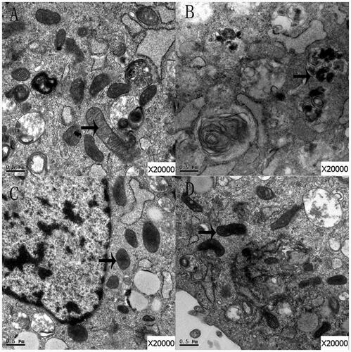 Figure 6. The mitochondria of cells in group control (A), group Bup1000 (B), group LE (C) and group Bup1000LE (D) were scanned by electron microscope. The arrow is mitochondria.
