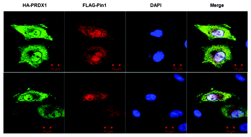 Figure 2. Sub-cellular co-localization of PRDX1 and Pin1. HeLa cells were co-transfected with HA-PRDX1/FLAG-Pin1 plasmids and immunostained with anti-HA (green) and anti-FLAG (red) antibodies. Nuclei were visualized by DAPI.