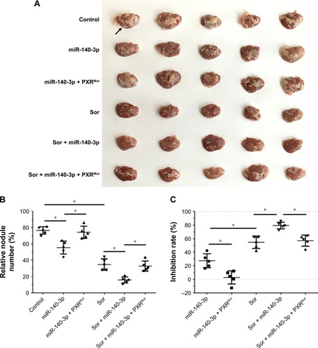 Figure 4 Transfection of miR-140-3p enhanced the antitumor effect of Sor on MHCC97-H cells’ intrahepatic growth.