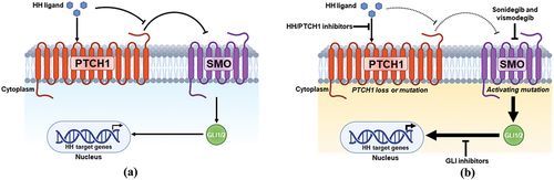 Figure 1. Schematic of the HH signaling pathway. (a) under physiologic conditions, binding of the Hedgehog (HH) ligand to patched homolog 1 (PTCH1), a negative regulator of smoothened (SMO), triggers SMO activation. SMO initiates an intracellular signaling cascade that causes glioma-associated oncogene homolog 1 and 2 (GLI1 and GLI2) activation and nuclear translocation. GLI1 and GLI2 are transcription factors that facilitate the induction of HH target gene expression. (b) PTCH1 loss-of-function mutations and/or SMO activating mutations cause aberrant HH pathway signaling that drives unregulated transcription and uncontrolled basal cell carcinoma (BCC) proliferation. Sonidegib and vismodegib are SMO antagonists, while other inhibitors are (i) HH/PTCH1 inhibitors (Robotnikinin, 7_3d3, 5E1 monoclonal antibody therapy, and RU-SKI 43) or (ii) GLI inhibitors (GANT-58, GANT-61, and arsenic trioxide). Created with BioRender.com.