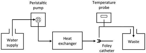 Figure 1. Schematic of apparatus used for irrigation of the bladder with warm water in order to achieve bladder-localised mild hyperthermia.