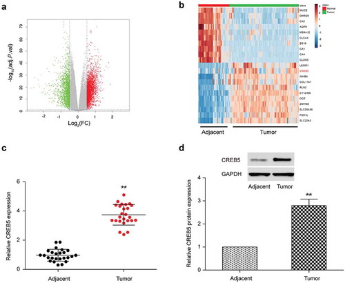 Figure 5. CREB5 was under-expressed in colorectal cancer tissues and cells. (a) Volcano plot. (b) Heat map. (c) qRT-PCR results of CREB5 in colorectal cancer tissues and adjacent normal tissues. (d) Western blot results of CREB5 in colorectal cancer tissues and adjacent normal tissues. ** P＜0.01, compared with Adjacent group.