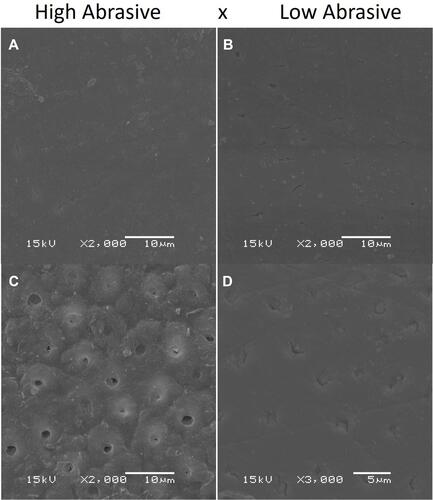 Figure 3 Dentin: (A) and (B) with bleaching and without erosion; and (C) and (D) with bleaching and with erosion.