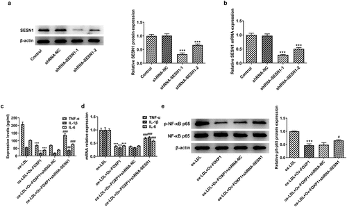 Figure 5. SESN1 knockdown alleviated the impacts of FOXP1 upregulation on inflammation in RAW264.7 cells induced by ox-LDL. The expression of SESN1 was assessed with (a) Western blotting and (b) RT-qPCR. ***P < 0.001 vs. shRNA-NC. Measurement of TNF-α, IL-1β and IL-6 levels using (c) ELISA and (d) RT-qPCR. (e) Detection of p-NF-κB p65 expression by Western blotting. ***P < 0.001 vs. ox-LDL; #P < 0.05, ##P < 0.01, ###P < 0.001 vs. ox-LDL+Ov-FOXP1+ shRNA-NC.