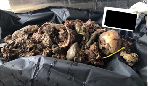 Figure 2. Decomposed body parts received at the Medico-Legal Institute.
