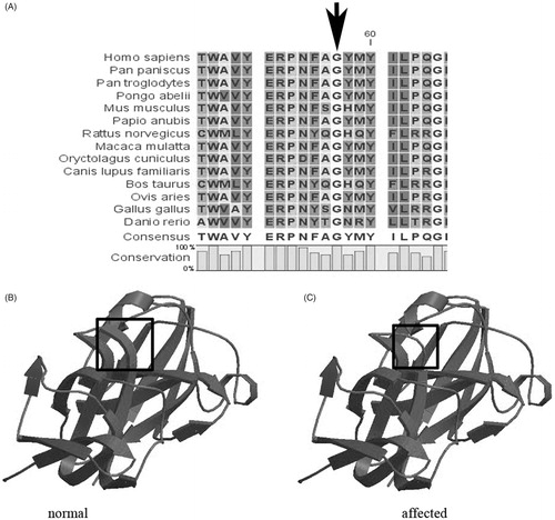 FIGURE 1. Protein models of the wild-type and mutant CRYGS. (A) A multiple-sequence alignment of the amino acid sequence in CRYGS from different species. The alignment data indicates that the Gly at the 57th amino acid position is highly conserved among many species (indicated by an arrow). (B) A structural model of the wild-type CRYGS is displayed. (C) A structural alteration of the mutant CRYGS is displayed. The second Greek key motif was found to be partially disrupted around the substitution site in the three-dimensional structural model of the mutant CRYGS.