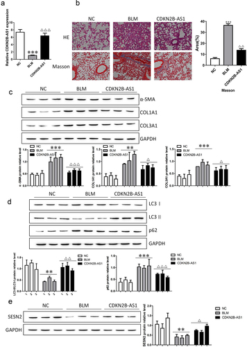 Figure 3. Increasing CDKN2B-AS1 mitigated pulmonary fibrosis under BLM treatment. a: RT–qPCR detection of CDKN2B-AS1 expression in mice. b: HE and Masson staining were used to discover the effect of CDKN2B-AS1 on BLM-induced lung fibrosis in mice. c: α-SMA, COL1A1, and COL3A1 protein expression levels were measured by Western blotting. d: Western blotting verification of LC3I, LC3II, and p62 protein expression. e: The expression level of the SESN2 protein was detected by Western blotting. ***p < 0.001 and **p < 0.01 compared with the NC group; ***p < 0.001, **p < 0.01, and *p < 0.05 compared with the BLM group. NC: negative control group, BLM: BLM-induced group, and CDKN2B-AS1: BLM-induced with CDKN2B-AS1-overexpression group. Data are presented as means ± SD (n = 3).