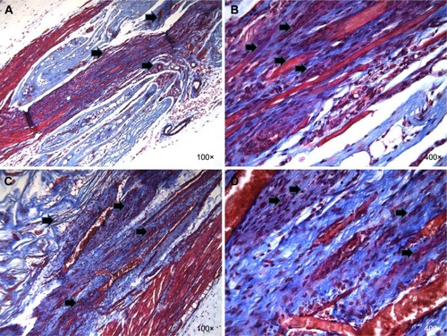 Figure 3 Evidence for new tissue formation in VML injuries repaired with TEMR–ADSC constructs.Notes: LD muscles repaired with TEMR–ADSC (n=13) constructs were retrieved 2 months postimplantation and analyzed for morphology and new tissue formation by Masson’s trichrome staining on paraffin-embedded histological sections. Red indicates muscle, blue indicates collagen, and black indicates nuclei in Masson’s trichrome staining. Neo tissue formation after repair with TEMR–ADSC constructs is shown in two representative animals. A and C display an overview of the native tissue and scaffold and B and D depict magnified view on the engineered side of the scaffold in two representative animals. Neo tissue formation is evident from signs of fusion, remodeling of the scaffold, and fiber formation on the scaffold part of the engineered muscle. Arrows indicate remodeling of the scaffold (A and C) or regenerating muscle fibers (B and D); # indicates the presence of vascular structures (blood vessels).Abbreviations: VML, volumetric muscle loss; TEMR, tissue-engineered muscle repair; ADSC, adipose-derived stem cell; LD, latissimus dorsi.