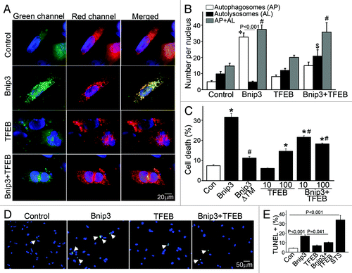 Figure 6. Forced expression of TFEB restores autophagosome processing and attenuates cell death in BNIP3-expressing NRCMs. (A) Representative epifluorescence images (630× magnification) demonstrating cellular localization of mCherry-GFP-LC3 in NRCMs adenovirally transduced with LacZ (as control), BNIP3, TFEB and BNIP3+TFEB for 48 h. Nuclei are blue (DAPI). Adenovirus coding for LacZ expression was added as necessary to result in equivalent MOIs (at total 200 MOI per treatment). (B) Quantitation of autophagosomes (green+red; white bars), autolysosomes (red, black bars) and both (gray bars) LC3 in NRCMs treated as in (A) (n = 25–40 nuclei/group). *p < 0.05 vs. autophagosomes, $p < 0.05 vs autolysosomes and #p < 0.05 vs. both in control group by post-hoc test. (C) Assessment of cell death in NRCMs transduced with LacZ (control), BNIP3, BNIP3ΔTM, TFEB (at MOIs = 10 and 100) and BNIP3+TFEB (at MOIs = 10 and 100) for 48 h. Adenovirus coding for LacZ expression was added as necessary to result in equivalent MOIs (at total 200 MOI per treatment). *p < 0.05 vs. control and #p < 0.05 vs. BNIP3 by post-hoc test. (D) Representative epifluorescence images (200× magnification) demonstrating TUNEL staining (green) in NRCMs treated as in (A). Nuclei are blue (DAPI). (E) Quantitative assessment of TUNEL positivity in NRCMs treated as in (A). Adenovirus coding for LacZ expression was added as necessary to result in equivalent MOIs (at total 200 MOI per treatment) for both (D and E). Treatment with staurosporine (1 μmol/L for 24 h) was employed as positive control (n = 5–9 experiments/group). p values are by post-hoc test.