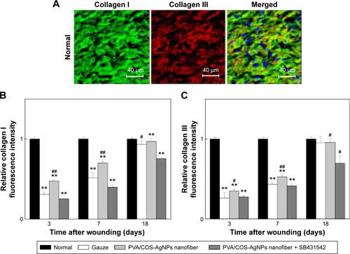 Figure S3 Increase in deposition of collagen I and collagen III over time in the three groups.Notes: (A) Immunofluorescent staining of collagen I and collagen III of normal skin (×800). (B) The relative collagen I fluorescence intensity in normal, gauze, PVA/COS-AgNPs nanofiber, PVA/COS-AgNPs nanofiber plus SB431542 at 3, 7, 12, 18 days post-wounding. (C) The relative collagen III fluorescence intensity in normal, gauze, PVA/COS-AgNPs nanofiber, PVA/COS-AgNPs nanofiber plus SB431542 at 3, 7, 12, 18 days post-wounding. Increased deposition of collagen I and III were observed in the PVA/COS-AgNPs nanofiber group at day 18. Values are mean ± standard deviation. *P<0.05 and **P<0.01 vs normal group, #P<0.05 and ##P<0.01 vs PVA/COS-AgNPs nanofiber plus SB431542 group.Abbreviations: PVA, poly(vinyl alcohol); COS, chitosan oligosaccharide; AgNPs, silver nanoparticles.