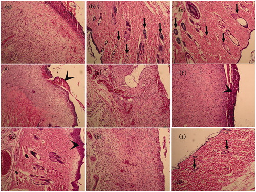 Figure 8. Pictures of HE-stained wound skin lesions that were administered drugs at 8 and 14 d (200× magnification): (a) PVA/SA, 14 d; (b) 2% MH/PVA/SA, 14 d; (c) Yunnan baiyao woundplast, 14 d; (d) received no treatment, 14 d; (e) PVA/SA, 8 d; (f) 2% MH/PVA/SA, 8 d; (g) Yunnan baiyao woundplast, 8 d; (h) received no treatment, 8 d; and (i) normal intact skin. Arrows indicate hair follicles or sebaceous gland, arrow head: wound curst.
