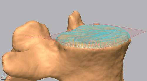 Figure 3. Example showing the creation of a datum plane representing the superior vertebral endplate extracted from surface data.