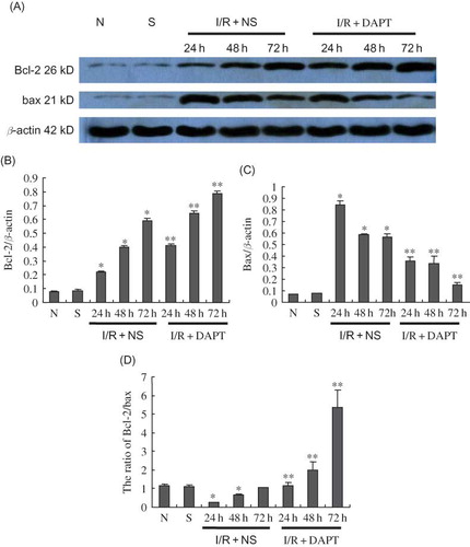 Figure 9. The expression of bcl-2 and bax protein (A–D): (A) Immunoblot analysis of bcl-2 and bax protein in kidneys. (B–D) Renal IRI induced the increase of bcl-2 and bax expression at 24 h post-reperfusion. However, bcl-2 protein continued to increase and bax expression gradually kept decreasing at 48 h and 72 h of post-reperfusion. DAPT treatment resulted in increased bcl-2 protein and decreased bax protein, giving a higher ratio between bcl-2 and bax. The band density was quantified. Values presented are ratios of bcl-2(or bax) to β-actin, which was used as an equal protein loading marker. Results are presented as mean ± SEM (n = 5), *p < 0.05 versus respective sham. **p < 0.05 versus respective IR + NS.) versus I/R + NS at the same time point.
