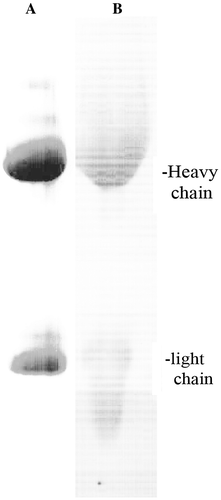 Figure 1. Analysis of immune complexes from synovial fluid of a patient with rheumatoid arthritis. (A) 10% polyacrylamide gel stained with Commassie Blue. (B) Western blot with homologous biotinylated IgG.Note: The results were representative of 5 preparations.