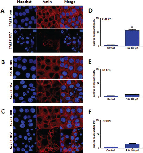 Figure 3. Morphological changes in resveratrol-treated OSCC. Fluorescent images of CAL27, SCC15, and SCC25 cells. These cells were stained with rhodamine-phalloidin to visualize actin filament and Hoechst staining to highlight nuclei. A, B, and C: Cells not treated with resveratrol had round nuclei and actin filament (0 μM). Cells treated with resveratrol (100 μM) for 24 h showed the production of nuclear condensation. (D, E, and F) The values below the micrographs are the mean ± SD (n = 3) of the mean of apoptotic cells as determined by Hoechst staining (*p < 0.05).