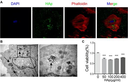 Figure 2 Internalization of nano-HAp by VSMCs and cell viability. (A) Laser scanning confocal microscopy (LSCM) image of VSMCs after incubation for 24 hours with green fluorescent-labeled nHAp. Cellular actins were stained with Phalloidin-Tritc (red), and nucleus were stained with Dapi (blue). (B) TEM image of VSMCs after incubation for 24 hours with 100 μg/mL nHAp. Black arrows point nHAp, N for nucleus. (C) Cell viability of VSMCs was measured with CCK8 assay after VSMCs were exposed to nHAp at different concentrations for 3 days. N=5, ***P < 0.001, compared with the control group.