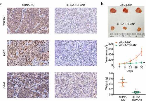 Figure 4. TSPAN1 promotes tumor growth of breast cancer in mice. (a) IHC assays showed the decreased levels of TSPAN1, Ki67, and p-AKT in control or TSPAN1 depletion tumor tissues. (b). Xenograft assay showed the tumor growth difference between control or TSPAN1 depletion mice. Data are shown as mean ± SEM, **p < 0.01