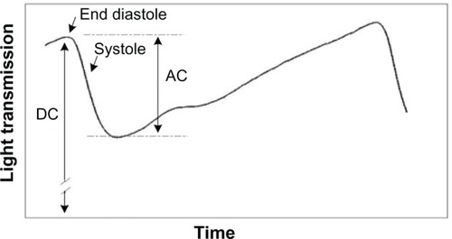 Figure 2 The photoplethysmography signal.