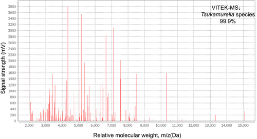 Figure 2 Mass spectra of the bacterial isolate. The isolate strain was identified by VITEK-MS.