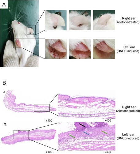 Figure 2. Construction of pathological eczema model in the left ears of mice. (A) Representative images of ear skins obtained from mice in control group. (B) Effects of DNCB induction on histopathological changes in ear. Representative microphotographs of ear sections stained with hematoxylin and eosin (HE), (a) right ear treated with acetone and (b) left ear induced by DNCB (HE staining, × 400). The photos showed that the connective tissue in the dermis had hyperplasia (black arrow); the inflammatory cells infiltrated in the dermis (blue arrow), and the new capillaries appeared (green arrows).
