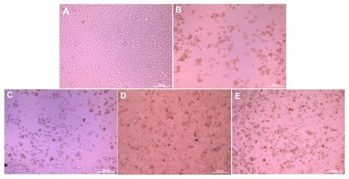 Figure 8 Morphology of HepG2 cells incubated with doxorubicin-loaded nanoparticles, the time was 36 hours and the concentration of doxorubicin was 15 μg/mL. (A) Cell culture plate, (B) doxorubicin hydrochloride, (C) doxorubicin, (D) doxorubicin-loaded mPEG45-PH15-PLLA82 nanoparticles, and (E) doxorubicin-loaded mPEG45-PH30-PLLA82 nanoparticles.Abbreviation: mPEG-PH-PLLA, methoxyl poly(ethylene glycol)-poly(L-histidine)-poly(L-lactide).