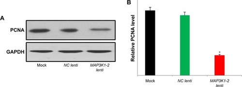 Figure 5 Western blot analysis of PCNA in MKN45 cells with or without lentivirus transfection. (A) Expression level of PCNA protein decreased in MKN45 with MAP3K1-2 lenti transfection. (B) Quantification of the results of the corresponding Western blot. Data are representative of results from three other experiments. *P<0.05 (mock: MKN45 without lentivirus transfection).