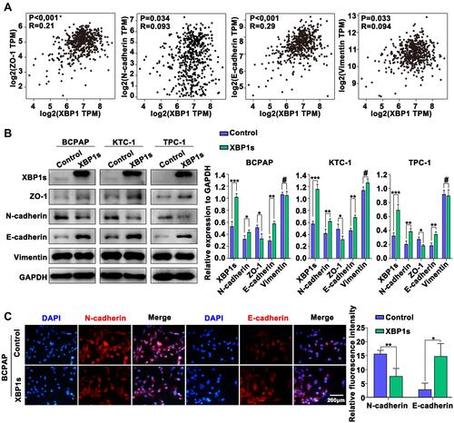 Figure 4 Overexpression of XBP1s inhibits EMT in PTC cells. (A) Correlation analysis between XBP1 and EMT-related markers (ZO-1, N-cadherin, E-cadherin and Vimentin) in TCGA (GEPIA). (B) Western blot analysis of the expression of XBP1s and EMT-related markers in PTC cells. (C) Immunofluorescence analysis of the expression of N-cadherin and E-cadherin in PTC cells. Difference between two groups was tested using two-tailed Student’s T-test. Data are expressed as the mean ± SD of each group of cells from three separate experiments. *P<0.05; **P<0.01; ***P<0.001, #P>0.05.