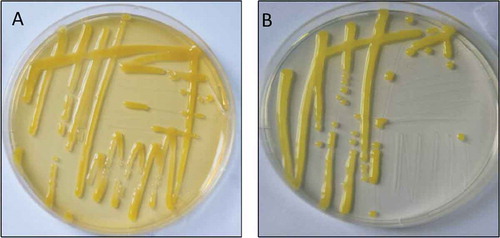 Fig. 3 (Colour online) Leaf spot disease isolates from symptomatic peach samples on Nutrient Agar (a) and Sucrose Peptone Agar (b) after 3 days of incubation at 28°C.