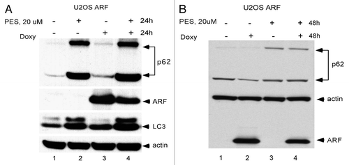 Figure 3 The HSP70 inhibitor phenylethynesolfonamide (PES) blocks ARF-mediated autophagy. (A) Protein gel analysis using antisera for the proteins indicated of whole cell lysate extracts from U2OS ARF cells treated with Doxycycline (Doxy) and/or PE S for 24 h, or left untreated. Shown are the monomeric (bottom) and oligomeric (top band) forms of p62SQSTM1, which accumulate in cells in which autophagy is inhibited, and LC3 (LC3 II), which also accumulates when autophagic flux is inhibited. (B) Protein gel analysis using antisera for the proteins indicated of whole cell lysate extracts from U2OS ARF cells treated with Doxycycline (Doxy) and/or PE S for 48 h, or left untreated. Shown are the monomeric (bottom) and oligomeric (top band) forms of p62SQSTM1, which decrease in autophagic cells, but accumulate in these cells when autophagy is inhibited.