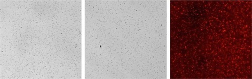 Figure 1 Photographs of tilmicosin-SLN and labeled tilmicosin-SLN (magnification was 10×40).Notes: Left, optical microscopy image of tilmicosin-SLN; middle, optical microscopy image of labeled tilmicosin-SLN; and right, fluorescence microscopy image of labeled tilmicosin-SLN. The fluorescence microscopy image of labeled tilmicosin-SLN was obtained at the same area of normal light.Abbreviation: SLN, solid lipid nanoparticle.