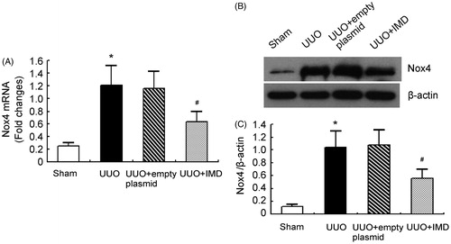 Figure 3. IMD inhibits NADPH oxidase Nox4 expression induced by UUO. (A) Nox4 mRNA expression measured by quantitative RT-PCR in the obstructed kidney of UUO rats. (B) Representative Nox4 protein expression measured by Western blot in the obstructed kidney of UUO rats. (C) Densitometric quantifications of band intensities from Western blot for Nox4/β-actin in the obstructed kidney of UUO rats. Data in bar graphs are means ± SD, n = 6. *p < .05 versus the sham control group; #p < .05 versus the UUO group.
