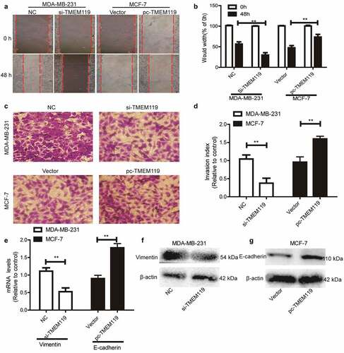 Figure 3. TMEM119 promotes the migration, invasion, and EMT process of breast cancer cells. (a and b) The migration ability of breast cancer cells with TMEM119 overexpression or knockdown was evaluated via wound healing assay. (c and d) The invasion ability of breast cancer cells with TMEM119 knockdown or overexpression was determined via transwell invasion analysis. (e–g) The expression of EMT markers was detected in breast cancer cells with TMEM119 knockdown or overexpression. n ≥ 3, **P < 0.01 vs. control