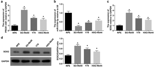 Figure 2. PROX1-AS1 and SOX2 are upregulated whereas miR-519d-3p is downregulated in RB cells. A, PROX1-AS1 expression in each cell line; B, miR-519d-3p expression in each cell line; C, SOX2 mRNA expression in each cell line; D, SOX2 protein expression in each cell line * P < 0.05 vs. the RPE cells; N = 3; the measurement data were expressed as mean ± standard deviation, one-way ANOVA was used for comparisons among multiple groups and Tukey’s post hoc test was used for pairwise comparisons after one-way ANOVA
