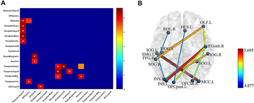 Figure 2 Significantly different FCs between the naPD and aPD groups. (A) T-value matrix of functional connectivity between the two groups. (B) Visualization of differential functional connectivity.