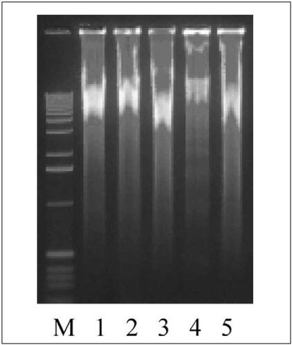 Figure 2.  Effect of PCR buffer on multiple displacement amplification (MDA) reaction. Whole genomic DNA was amplified from approximately 600 (lanes 1 and 2), 60 (lane 3), and 6 (lane 4) colony-forming units (cfus). All samples were heated at 98°C for 10 min in the presence of 2× PCR buffer before the MDA reactions except lane 1, which contained double-distilled water instead. Whole genomic DNA was also amplified using the genomic DNA purified from Salmonella enteritidis LK5 as a template (lane 5). A 1-kb DNA ladder (Invitrogen) was used as a standard marker (M).