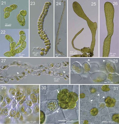 Figs 21–31. Development of thallus of Ryuguphycus kuaweuweu gen. et comb. nov. in unialgal culture. Figs 21, 22. Germlings. Figs 23, 24. Young biseriate erect thallus. Figs 25, 26. Young parenchymatous erect thalli. Fig. 27. Cross section of upper part of thallus showing hollow portion (arrowheads). Fig. 28. Cross section of mature zoidangia. Arrowheads show developing release pores. Fig. 29. Surface view of mature zoidangia in surface view. Note the remarkable size difference between large (arrowheads) and normal (arrows) zoids. Fig. 30. Mature zoidangia (arrowhead) and in situ germination of zoids (arrow) in surface view. Fig. 31. Surface view showing release pore (arrowheads) of zoidangia