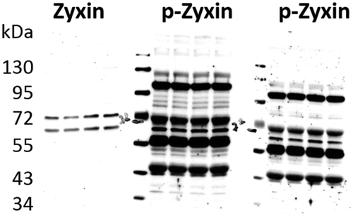Figure 5. Antibody specificity as an issue. Depicted are a full length anti-Zyxin antibody and two antibodies against phosphorylated Zyxin (p-Zyxin) from different vendors showing poor specificity. Importantly, there can be substantial differences between antibodies from different vendors.