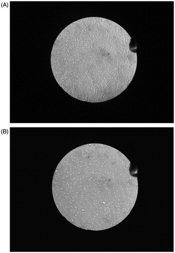 Figure 6. Photographs of cell viability assay of control L929 cell line (A) and nanoformulation tested on L929 cell line (B) n = 5 ± SD.