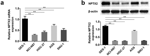 Figure 1. Expression of NPTX2 in gastric cancer cells. (a) The mRNA expression of NPTX2 was determined by qRT-PCR in gastric cancer cell lines (NCI-N87, HGC-27, AGS and SNU-1) and normal human gastric mucosal cells (GES-1). (b) The protein expression of NPTX2 was measured by western blot. **p < 0.01 versus GES-1 cells