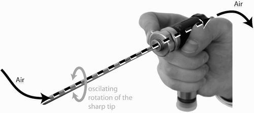 Figure 2. The shaver is a motor-driven instrument used for the removal of inflamed tissue.