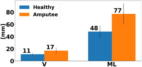 Figure 1. Mean dML and dV for amputees and healthy subjects (V: dV, ML: dML).