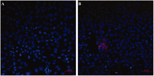 Figure 6. Confocal images of K1 cells incubated with the prepared NPs (blue colour indicates cell nucleus and red for the Cy 5.5 labelled nanoparticles): (A) Cy5.5-labelled FTY720@SF-Se NPs, and (B) Cy5.5-labelled FTY720@T7-SF-Se NPs (B) after 6 h.